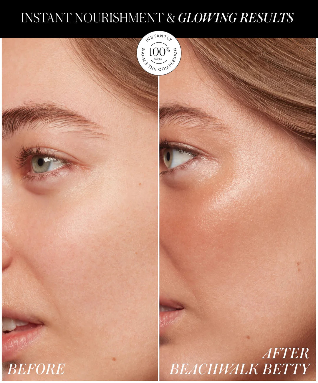 RMS | ReDimension Hydra Bronzer