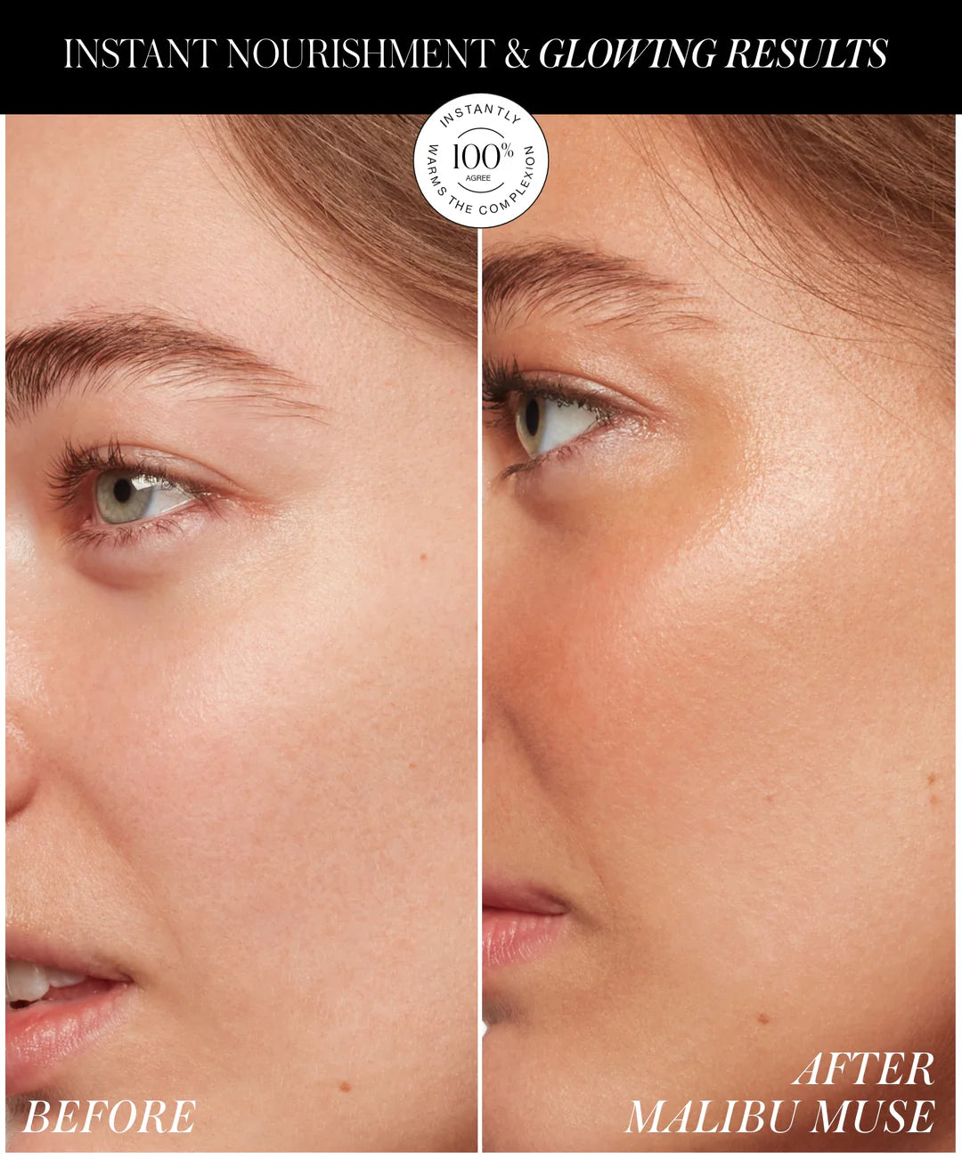 RMS | ReDimension Hydra Bronzer